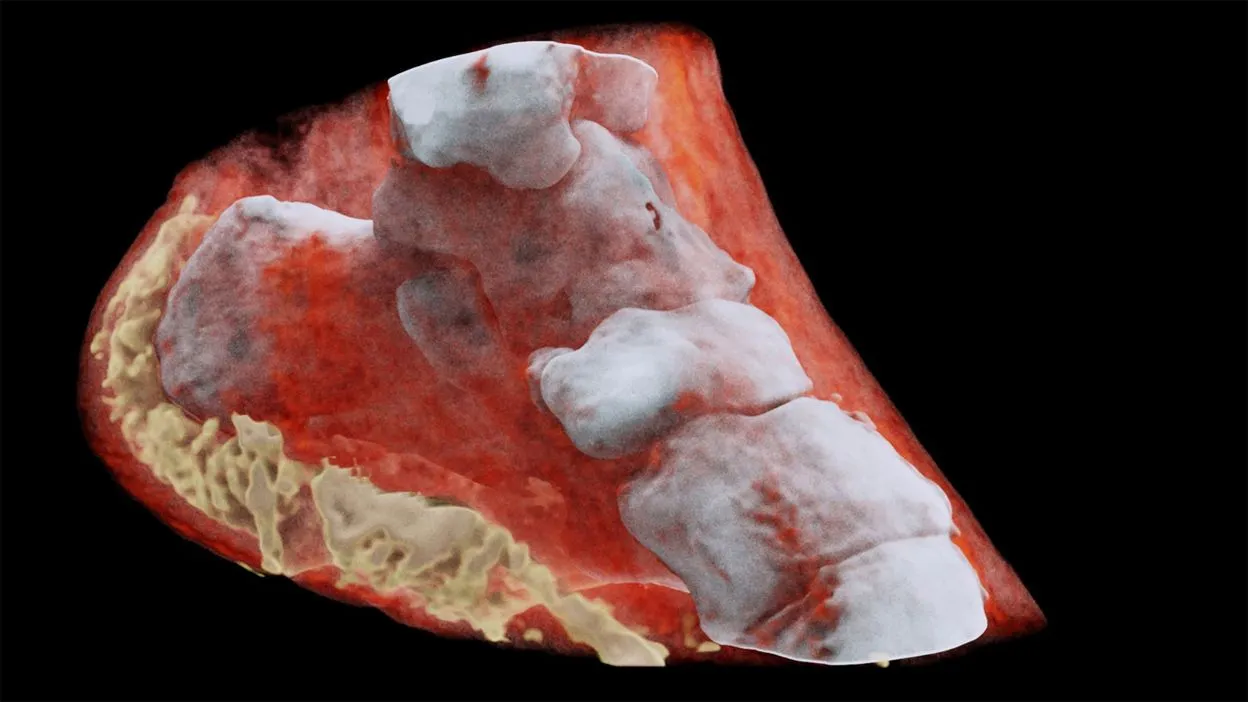 Première radiographie couleur 3D d’un humain